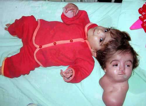 割头手术(组图)