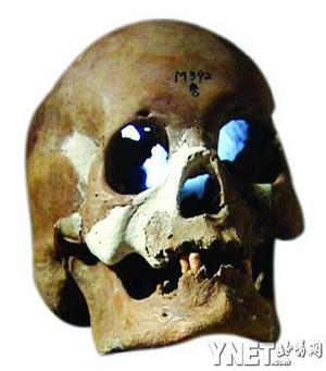 5000年前中国就有开颅术?