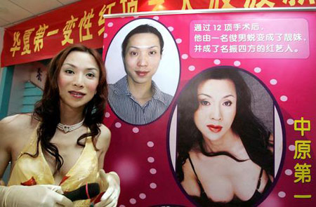 生殖器变性手术,将使波波成为一个真正意义上的