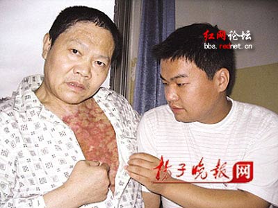 殷武勇:三度割头皮为重度烫伤父亲植皮的孝子