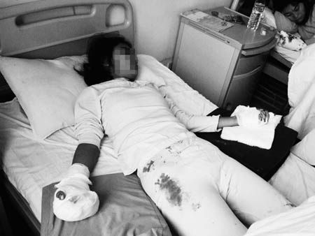 15岁<em>女生</em>夜晚遇歹徒+双手夺利刃脱身(图)