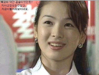 \天然美女\宋慧乔整容前后对比图(组图)