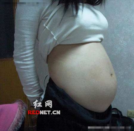 致使两<em>女生怀孕</em>,因<em>胎儿</em>月份太大不适宜引产便