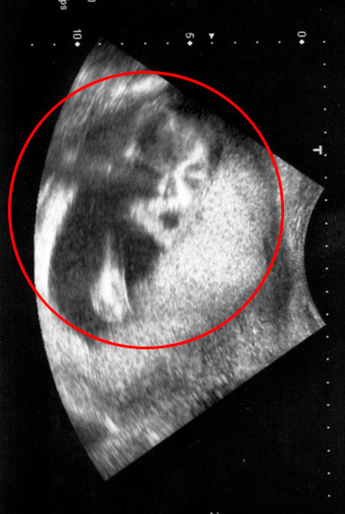 孕妇道恩·凯莉的b超照片上竟出现迈克尔·杰克逊的影像