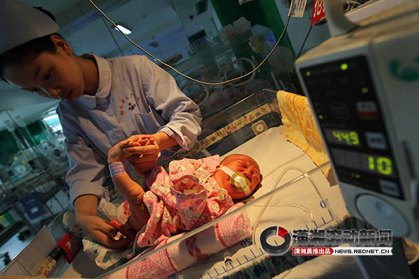 女婴臀部长出两只小脚 确诊不对称连体畸形[图]