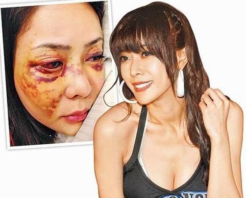 遭男友虐待暴打软禁痛不欲生女星家居照(图)_