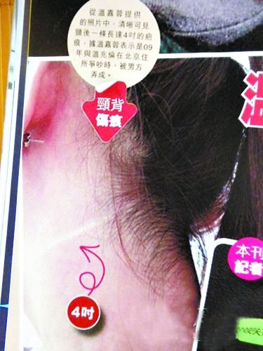 [视频]曝温兆伦刀砍女友 旧爱哭诉晒伤口照