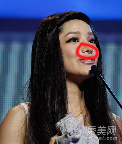  超女冠军 江映蓉陷整容门 家居生活照有真相(