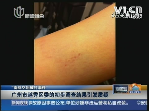 [<em>视频</em>]常委打<em>空姐</em>后道歉续:目击者揭露真实内幕