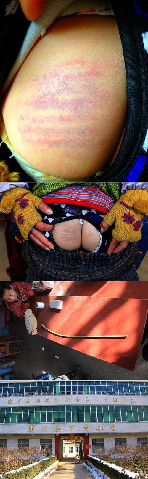 河南四岁幼儿没带作业本 遭俩老师轮流鞭打(图)