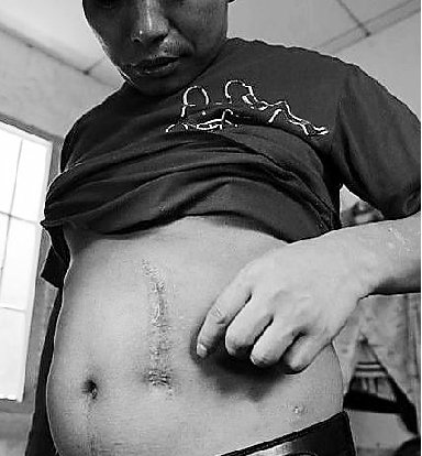 浙江买卖人体器官案:9名被告6人卖掉自己的肾