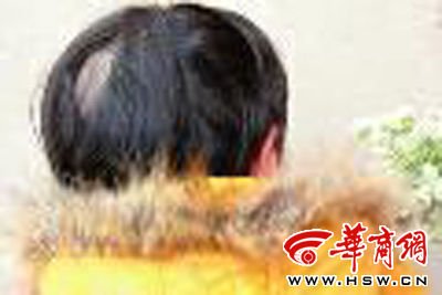 家长因自己<em>孩子</em>被掐 竟揪掉<em>3岁</em>女童<em>头发</em>_教育
