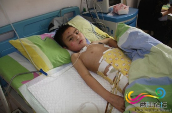 8岁男孩从山崖摔下尖石刺穿肚子多内脏破裂（图）