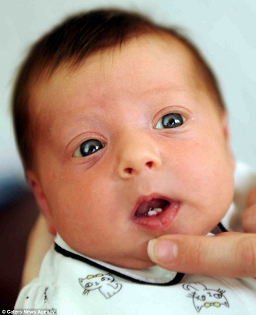 英国新生宝宝长着两颗牙几率为两千分之一（图）