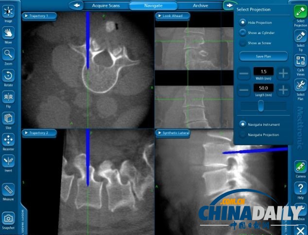 英国医院首次使用革命性3D扫描仪 可降低手术风险