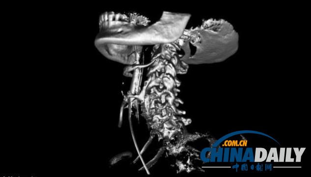 英国医院首次使用革命性3D扫描仪 可降低手术风险