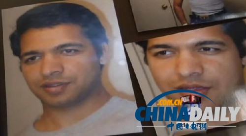 纽约帅气离异男22次整形手术后鼻子感染被割掉