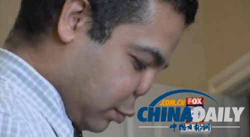 纽约帅气离异男22次整形手术后鼻子感染被割掉