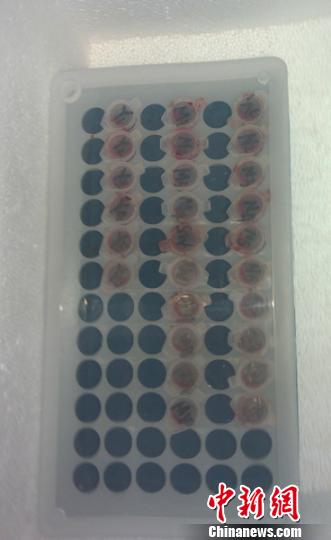 南京一研究生将珍贵动物血清标本遗落地铁车厢 狄公宣 摄
