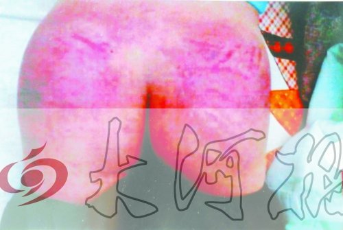 小学生被怀疑偷校长表 两天遭4次毒打(图)