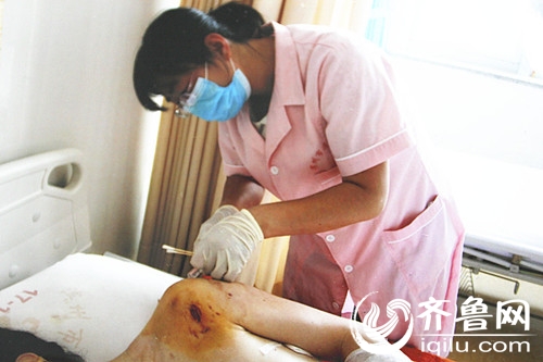王女士在接受治疗