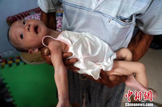 “饥饿娃娃”常笑在姥爷的手里显得非常娇小 周小云 摄
