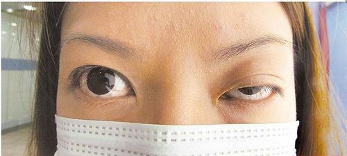 台湾新娘打肉毒杆菌变大小眼 蜜月照镜就哭(图)