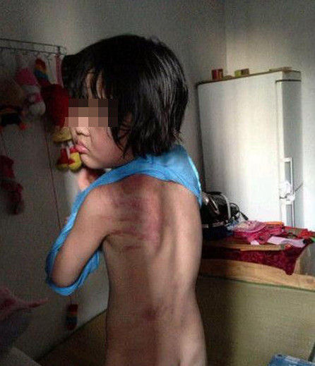 今年7岁的小女孩小豆子(化名)