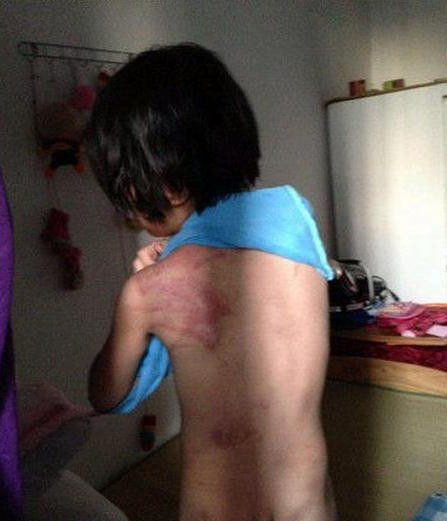 今年7岁的小女孩小豆子(化名)