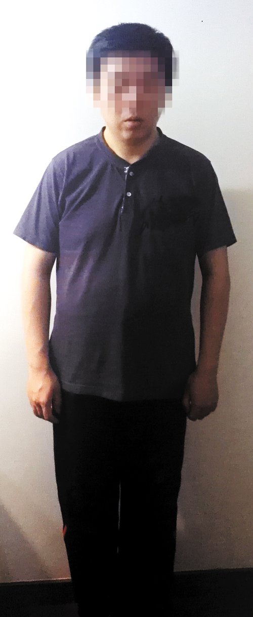 男孩激素治足癣后多病缠身 13年后仍未获赔偿