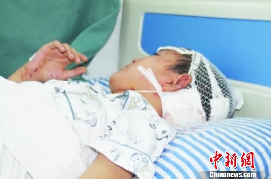 侥幸逃脱的小男孩在接受医治　蒋智兴　摄
