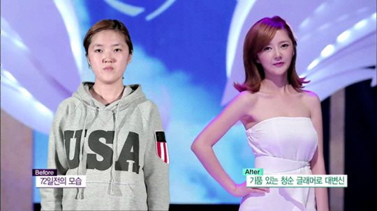 韩女子被丈夫嫌丑遭打骂 整容后丈夫态度大转变