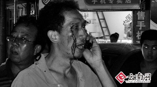 李先生被打伤鲜血直流视频截图