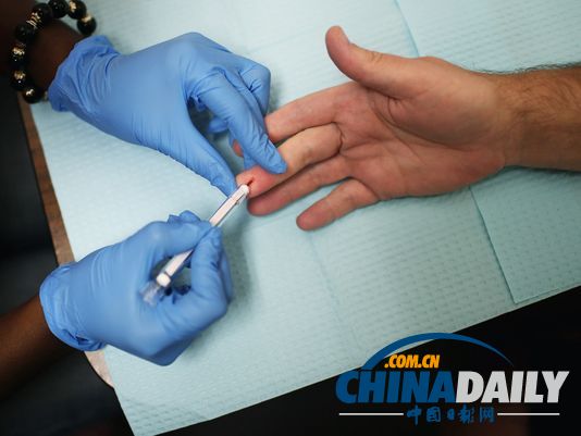 众多医学专家呼吁成人电影演员接受例行的艾滋病检查。