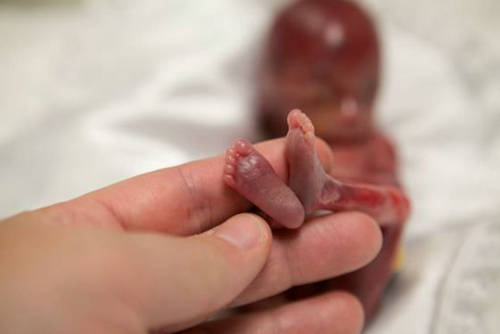 胎儿的小脚丫已经完全形成