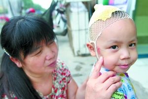 孩子伤口