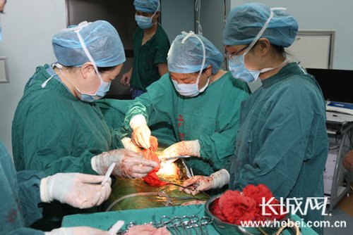 孕妇肚子太大以为怀双胞胎 剖腹发现是子宫肌瘤