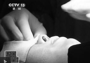 爱美者使用奥美定发生感染后，鼻头发生了严重变形。