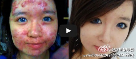 [<em>视频</em>]超恐怖痘痘女神奇遮痘<em>法</em> 这是逆天的节奏