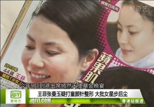 [视频]王菲张曼玉疑打童颜针整形 大批女星步后