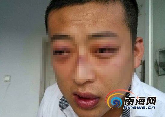 三亚一大学生称晚归遭保安殴打 学校称没这事