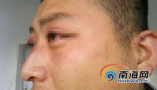三亚一大学生称晚归遭保安殴打 学校称没这事