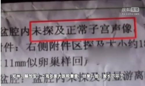 一名10岁女孩在河南省第二人民医院诊断为阑尾炎,做了阑尾切除手术,让