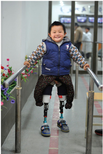 [视频]3岁男孩失双腿 装假肢每天微笑练习8小时