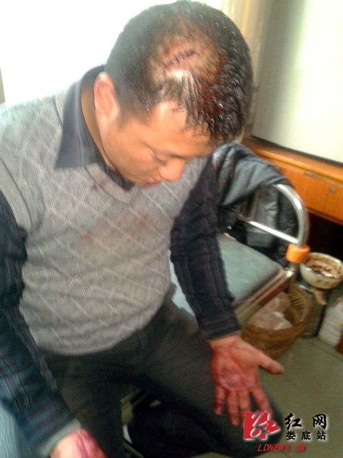 受伤后的伍沅脸上和手上沾满鲜血