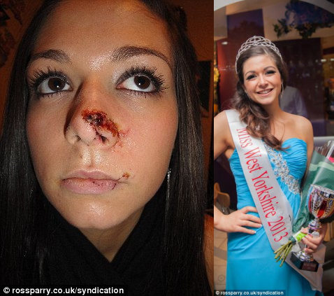 女孩遭殴打“破相”不气馁参加选美赢自信(图)