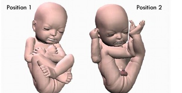 3D打印带你见未出生胎儿！体位表情皮肤性别皆可见