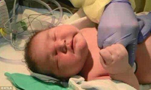 美国一母亲产下7公斤婴儿打破加州记录（图）
