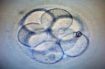 显微镜中正在培育的胚胎。