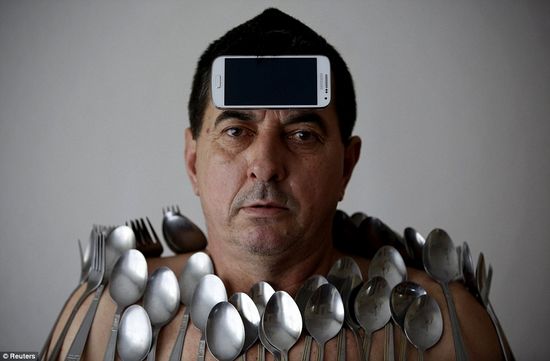 男子身体如磁铁能吸附餐叉手机等多种物品（图）